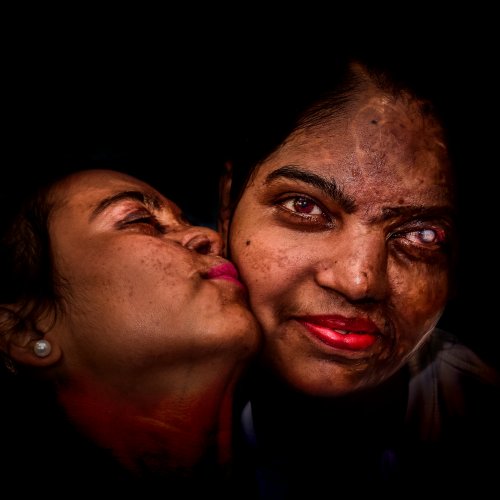 poza portrait fete indience victime atac acid Debdatta Chakraborty